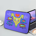 Yallow Dog Laptop Sleeve (13-Inch)